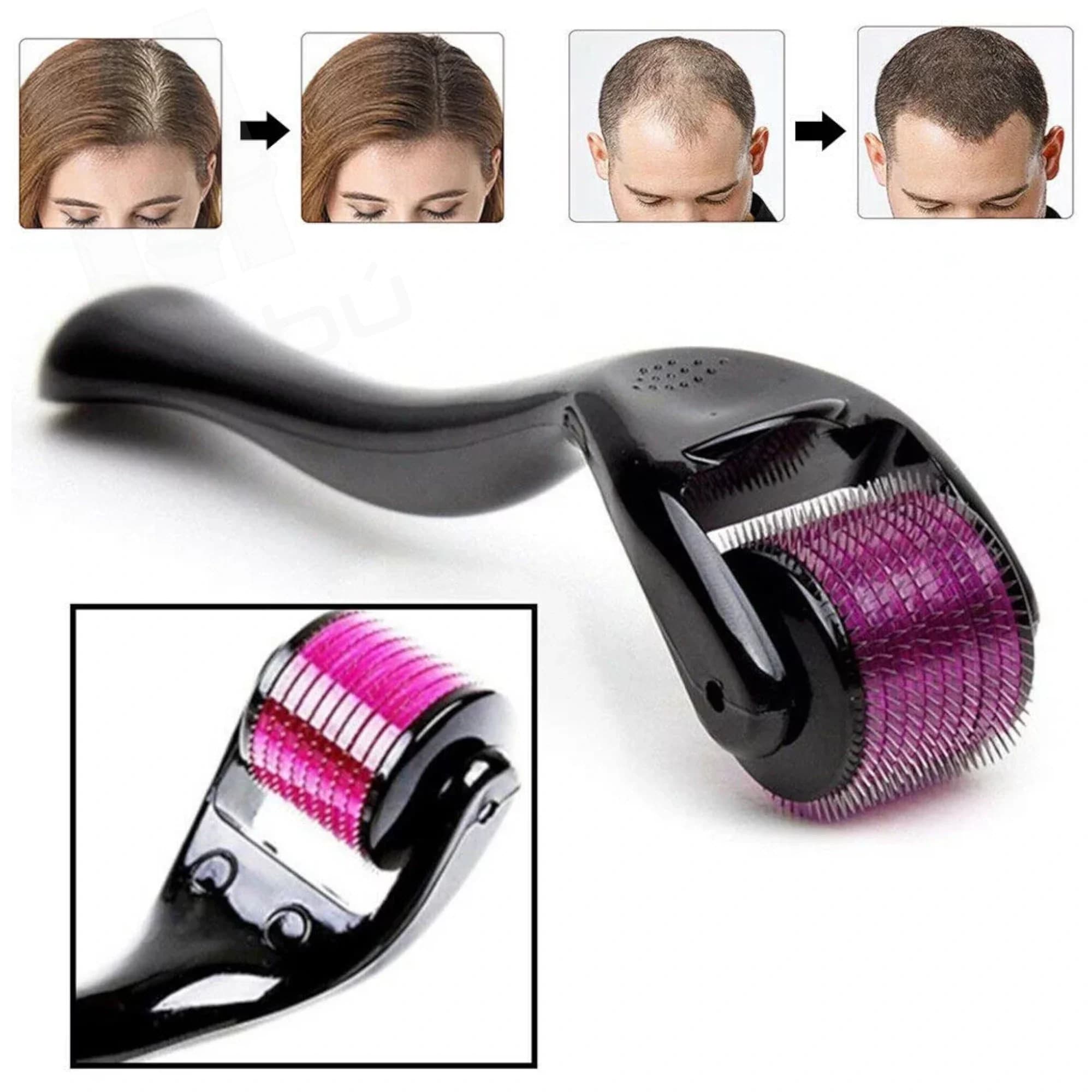 Rodillo Dermaroller de Titanio Negro 1.5mm 540 agujas - Estándar